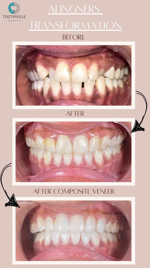 LP - Braces 3 WhatsApp Image 2025-09-22 at 12.39.15 PM